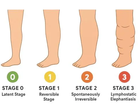 Hình 3. Từ suy giảm chức năng tiềm ẩn đến phù biểu hiện