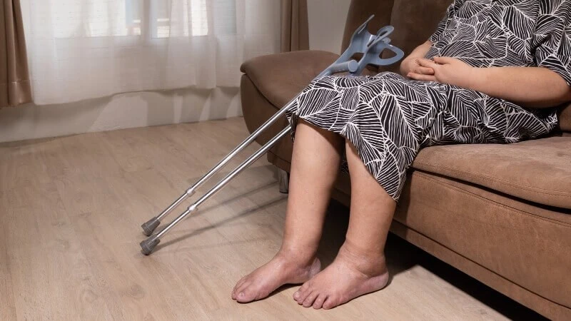 Tại sao sau tai biến và liệt lại có nguy cơ phù?